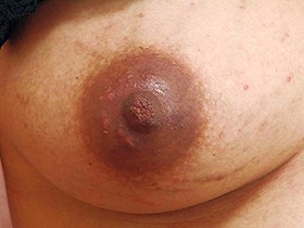 乳首観察　サンプル画像02